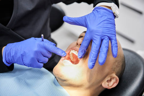 Best Emergency Cosmetic Dentistry (e.g., broken veneers) in Monsey, NY
