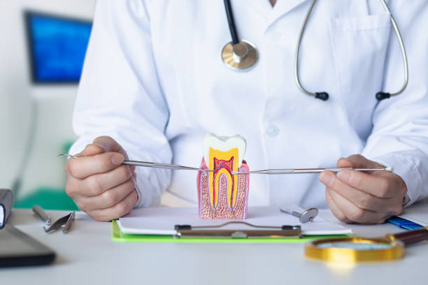 Best Knocked-Out Tooth (Avulsed Tooth) Treatment in Monsey, NY